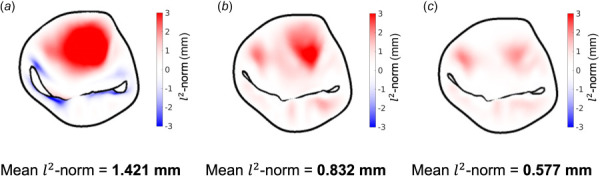 (a) The l2 norm between the simulated geometry and the target ES geometry. The mean intersurface distance is 1.421 mm, and there is a notably large region of mismatch in the anterior belly, likely because there are comparably few insertion points in this region. (b) The l2 norm after the updated MVCT prestrain is incorporated and the simulation is looped to convergence. The mean intersurface distance has decreased to 0.832 mm, and while the anterior belly region still demonstrates notable mismatch, both the spread and intensity of the error have decreased. (c) The l2 norm after the updated MV leaflet prestrain is incorporated and the simulation is looped to convergence. The mean intersurface distance has dropped to 0.577 mm, which is below our acceptable maximum of 1 mm. Moreover, the error in the anterior belly has significantly decreased.