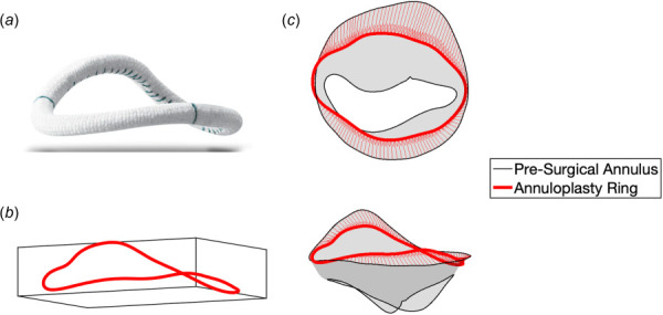 The postoperative annuloplasty ring boundary condition. (a) The Medtronic Profile 3D ring, one of the devices that the 3 patients received. (b) The postoperative annular boundary, from the target post-ES leaflet geometry. (c) The annular displacement from the pre-operative ED state to the ring dimensions.