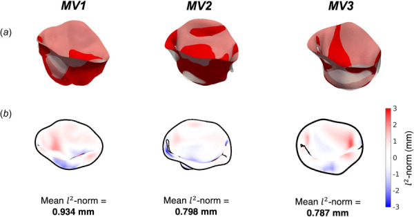 The predicted postoperative geometries using the pre-operative ED MV leaflet geometry, calibrated prestrains, annuloplasty ring boundary condition, anatomically distributed MVCT and rt-3DE traced MVCT origins for all 3 patient MVs (MV1: recurrent; MV2: recurrent; MV3: nonrecurrent). (a) The predicted ES geometry overlaid with the target postoperative ES geometry segmented from rt-3DE. (b) The l2 norm between the predicted and target geometries, demonstrating submillimeter agreement.