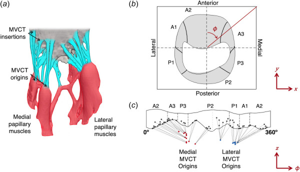 The MV apparatus anatomy from the rt-3DE patient scans and ex vivo CT-imaged human hearts. (a) The subannular structure of a representative CT-imaged ex vivo cardiac reconstruction. MVCT are colored in cyan, and papillary muscles are highlighted in red. Black arrows indicate a subset of MVCT insertions and origins. (b)Arepresentative patient-specific ED leaflet geometry segmented and meshed from rt-3DE imaging, shown in the atrial view. The Carpentier segments are labeled, and the angular coordinate ϕ is shown. Note that ϕ = 0 approximately bisects the A2 segment. (c) A 2D representation of an ex vivo MV with the Carpentier segments and angular coordinate marked, and its MVCT insertions and corresponding medial and lateral MVCT origins are shown in gray, red, and blue, respectively. (Color version online.)
