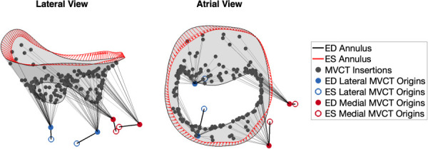 The final patient-specific full MV apparatus, shown in the lateral and atrial views. The ED MV leaflet geometry is segmented from rt-3DE imaging; the MVCT insertions are distributed according to the insertion density map (shown in gray); and the four representative MVCT origins and their ED to ES displacements (guided by the rt-3DE traced MVCT origin displacements) are shown in blue (lateral) and red (medial). The red boundary denotes the pre-operative ES state annulus, and the arrows indicate the annular displacement boundary condition. (Color version online.)