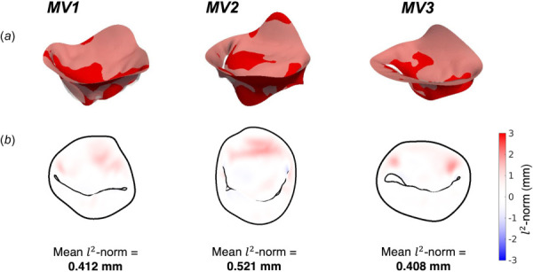 The final results from the pre-operative calibration using 160 anatomically distributed MVCT and rt-3DE traced MVCT origins for all 3 patient MVs (MV1: recurrent; MV2: recurrent; MV3: nonrecurrent). (a) The simulated geometry overlaid with the target pre-operative ES geometry. (b) The l2 norm between the simulated and target geometries, demonstrates close agreement after calibration of the MV leaflet and MVCT prestrains.
