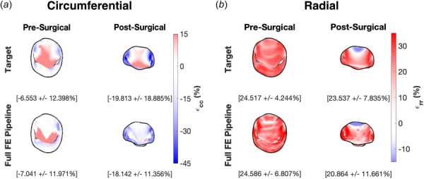 The circumferential and radial MV leaflet strain fields pre- and post-repair computed using our extensively validated noninvasive strain estimation technique and the full finite-element pipeline. The means of the strain fields correspond closely in both directions, both for the pre-operative simulations and the postoperative predictions.