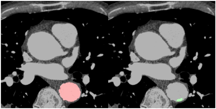 Fig 5