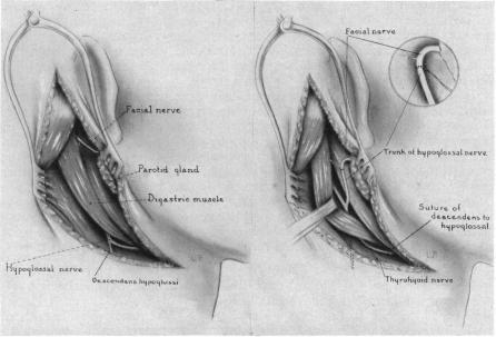 FIG. 16, 17.