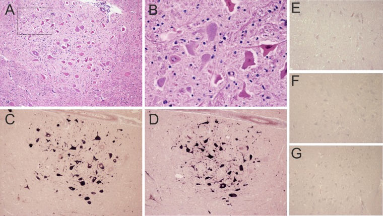 FIG 2