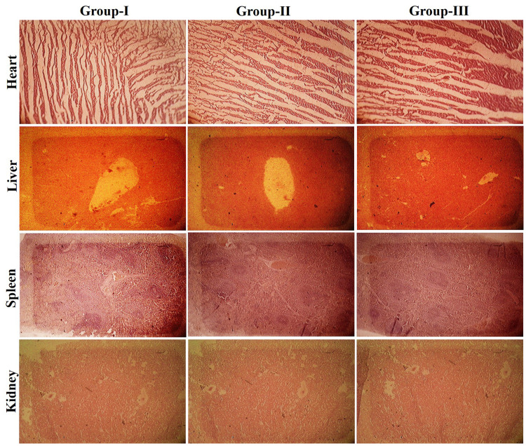 Figure 11