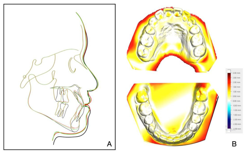 Figure 11