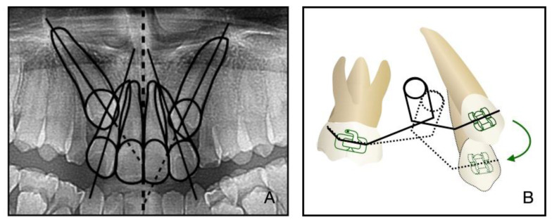 Figure 12