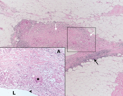 Figure 2)