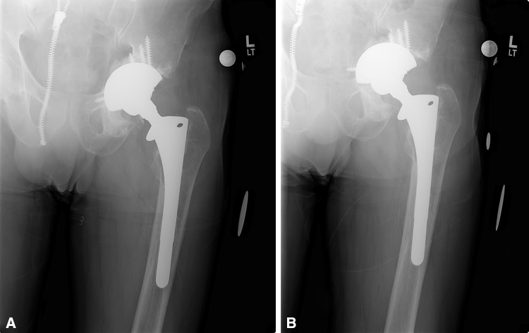 Fig. 4A–B