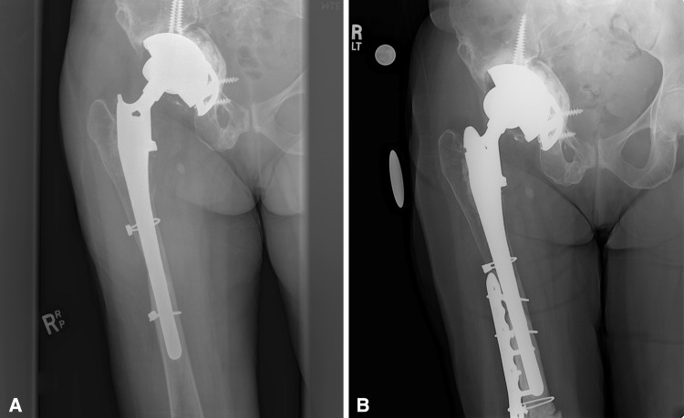 Fig. 3A–B