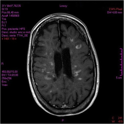 Fig. 2