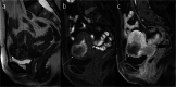 Fig. 12