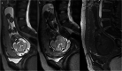 Fig. 15