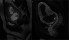 Fig. 14