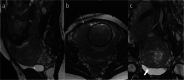 Fig. 16