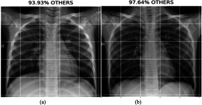 Fig. 12