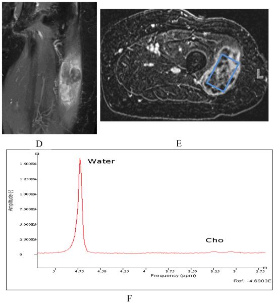 Figure 3.2