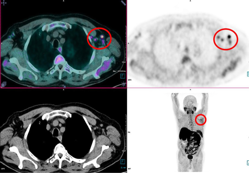 FIGURE 4