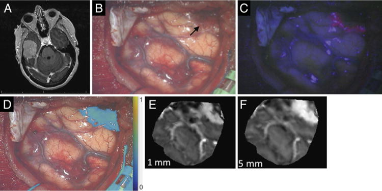 FIG. 5