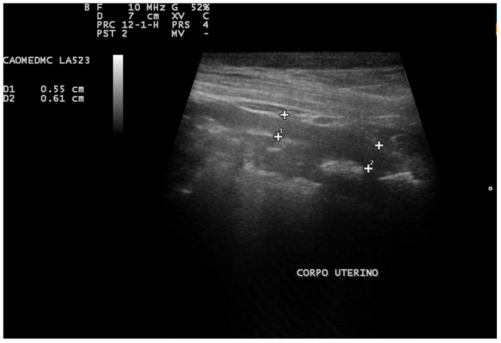Figure 6