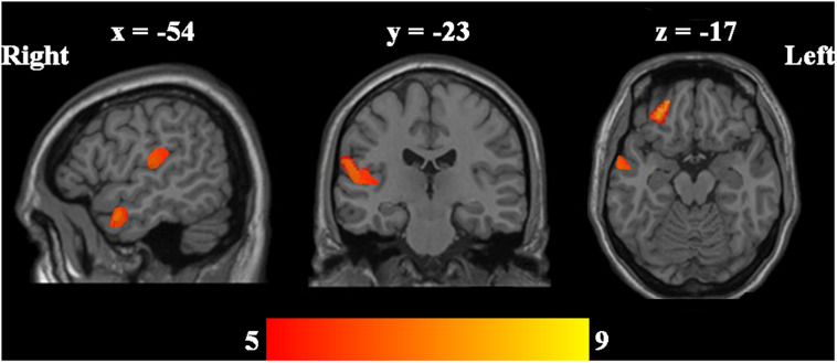 FIGURE 1