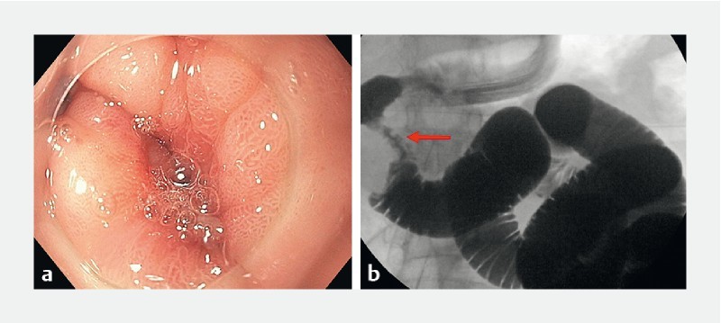 Fig. 1