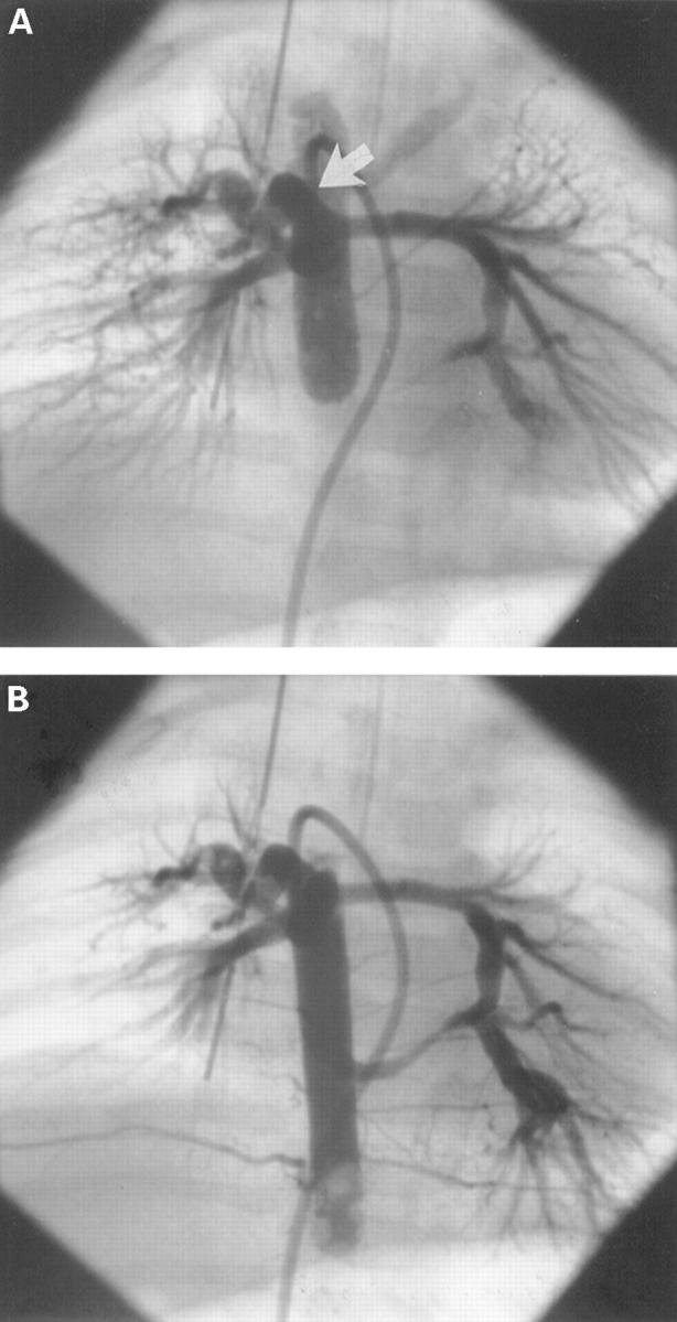 Figure 4  