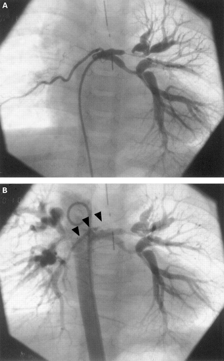 Figure 3  