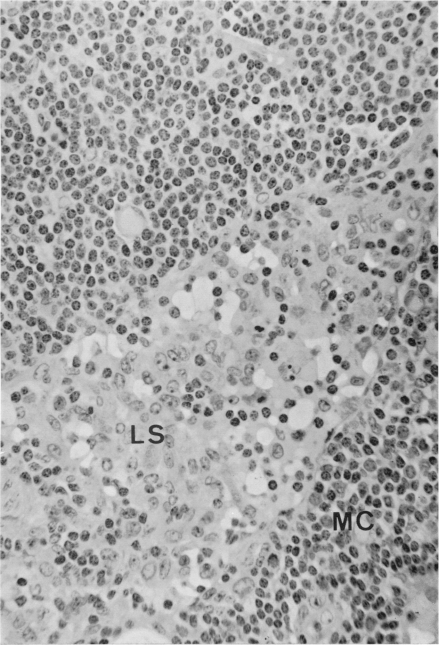 Figure 22