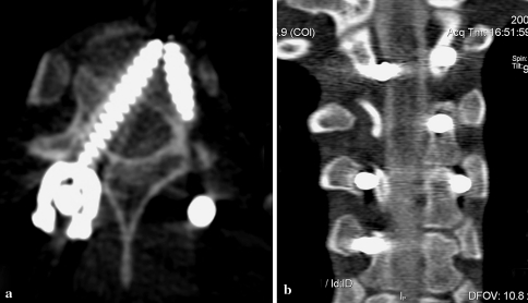 Fig. 2