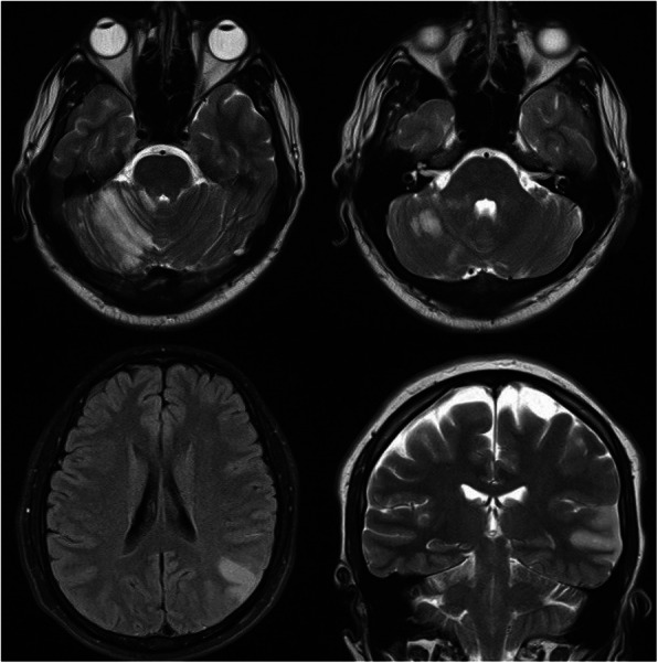 Fig. 2