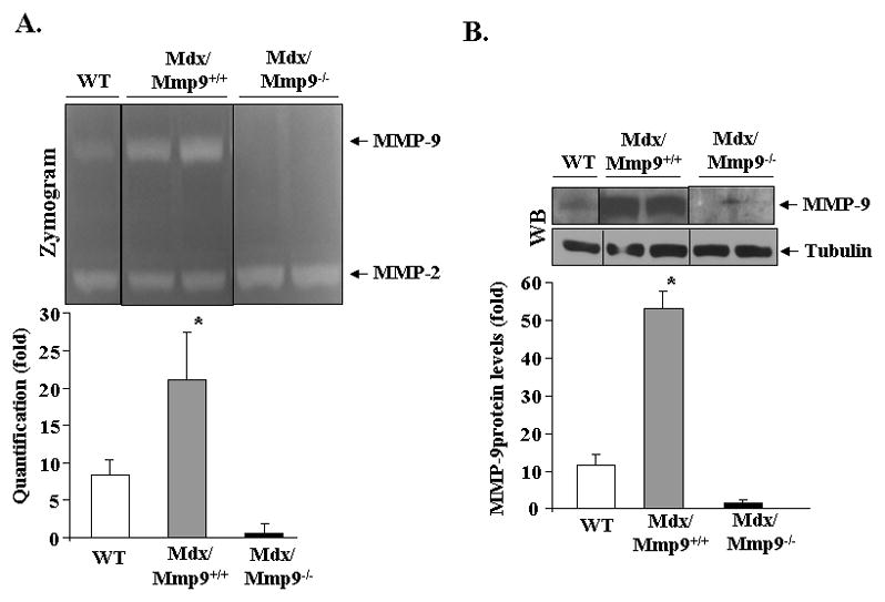 Osteopontin-stimulated Expression Of Matrix Metalloproteinase-9 Causes 