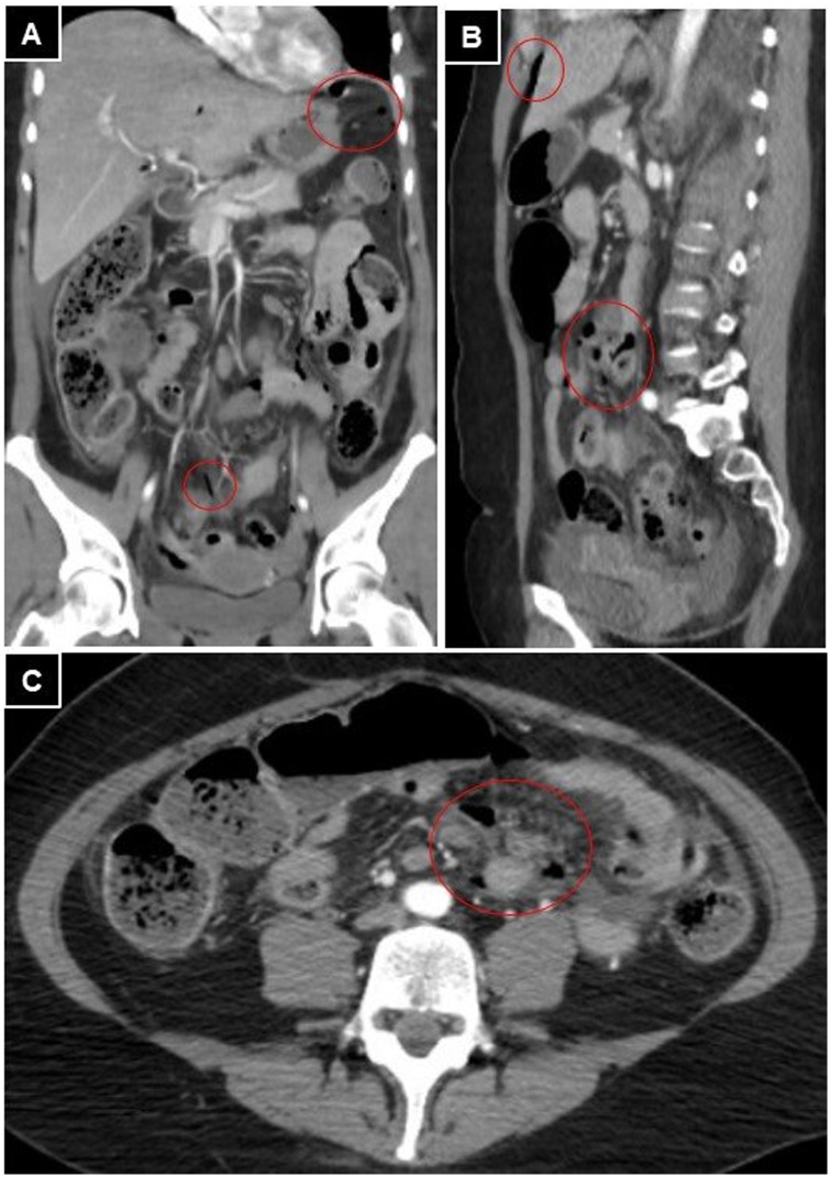 Fig. 3