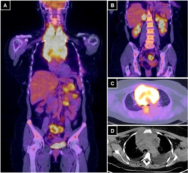 Fig. 2