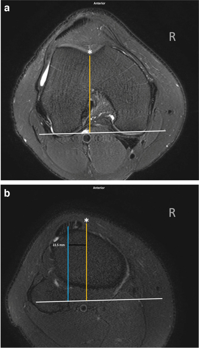 Fig. 5