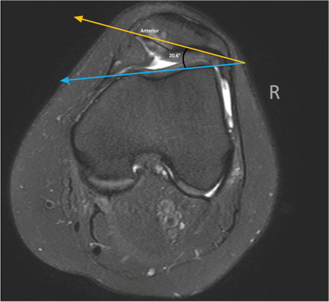 Fig. 6