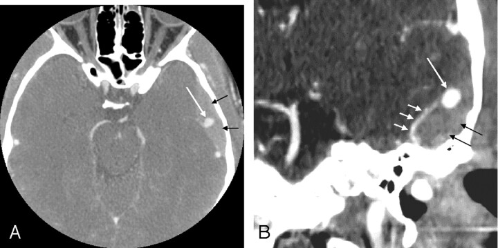 Fig 1.