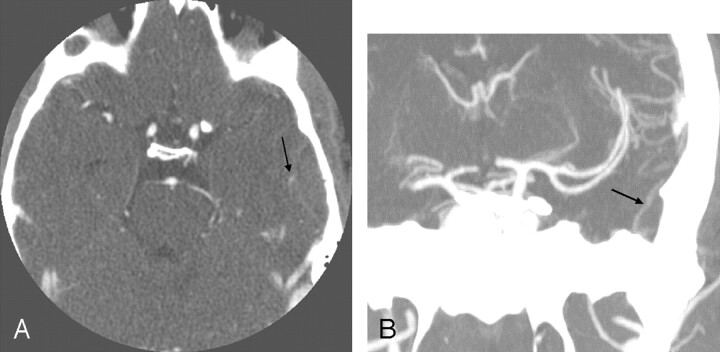 Fig 2.