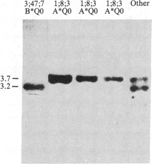 graphic file with name pnas00344-0144-a.jpg