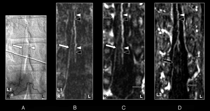 Fig 4.