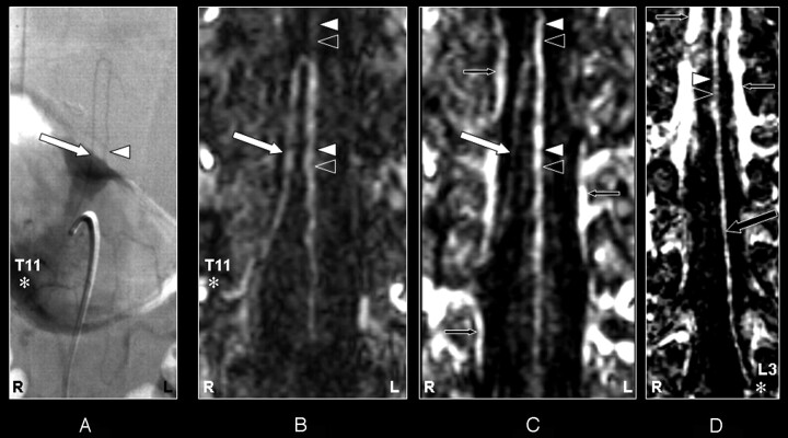 Fig 3.