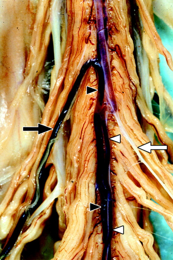 Fig 1.