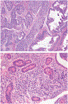 FIGURE 11.