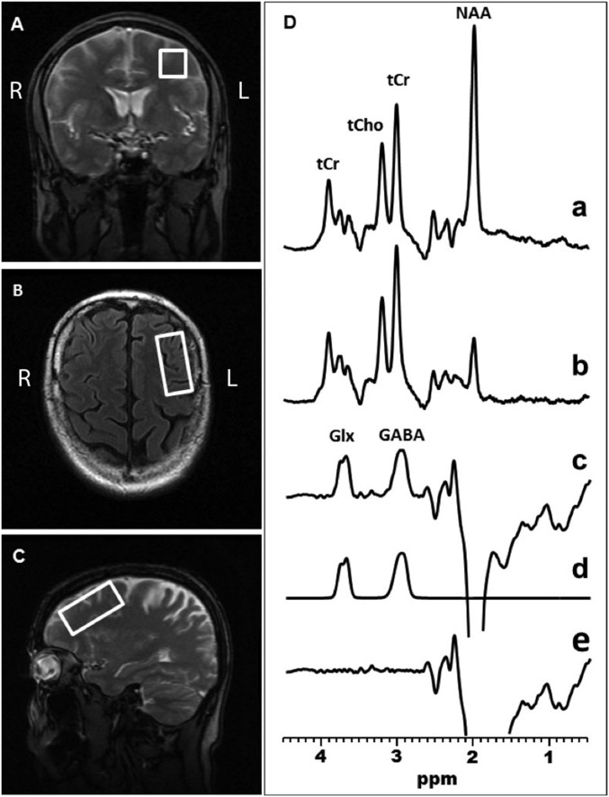 Fig. 3.