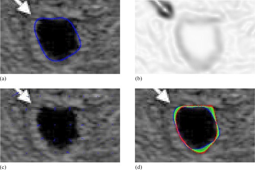 Figure 17