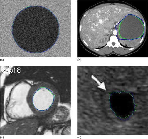 Figure 18