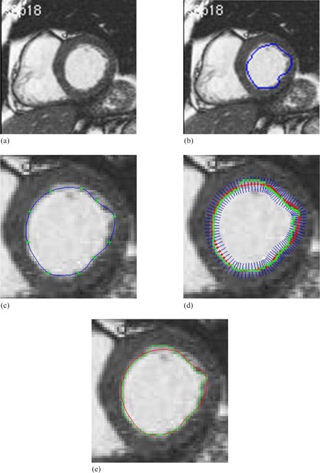 Figure 13