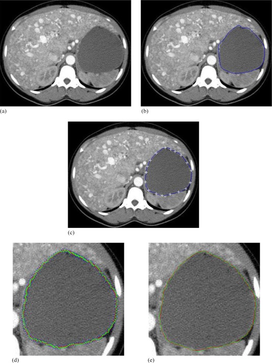 Figure 12